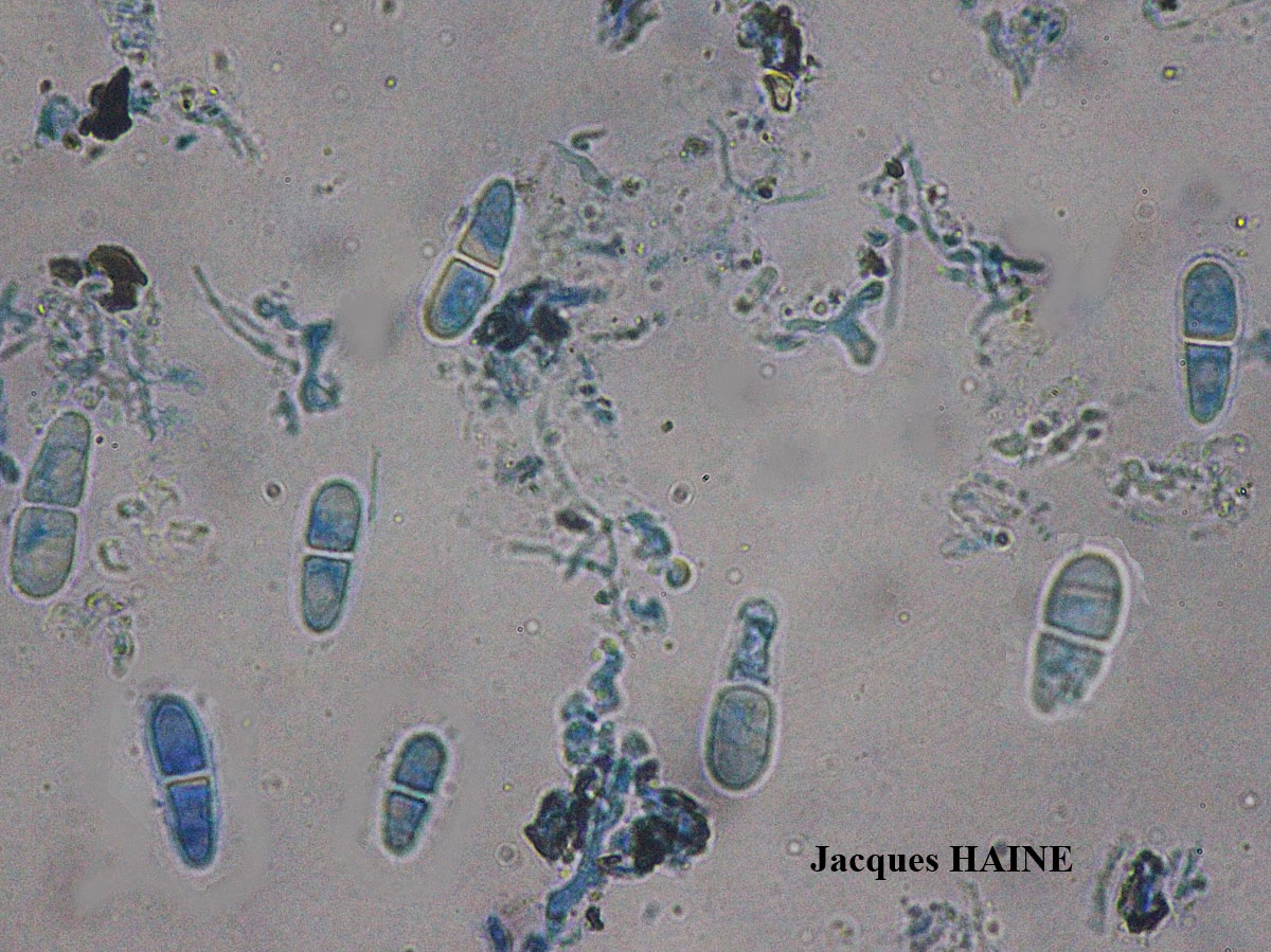 Collemopsidium ostrearum Taxon Atlantique-Manche forme sur Patella.